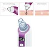 Уред за лице Beurer FC 41 Deep pore cleanser, vacuum technology, LCD display, 3 attachments, 5 speed levels, for all skin types